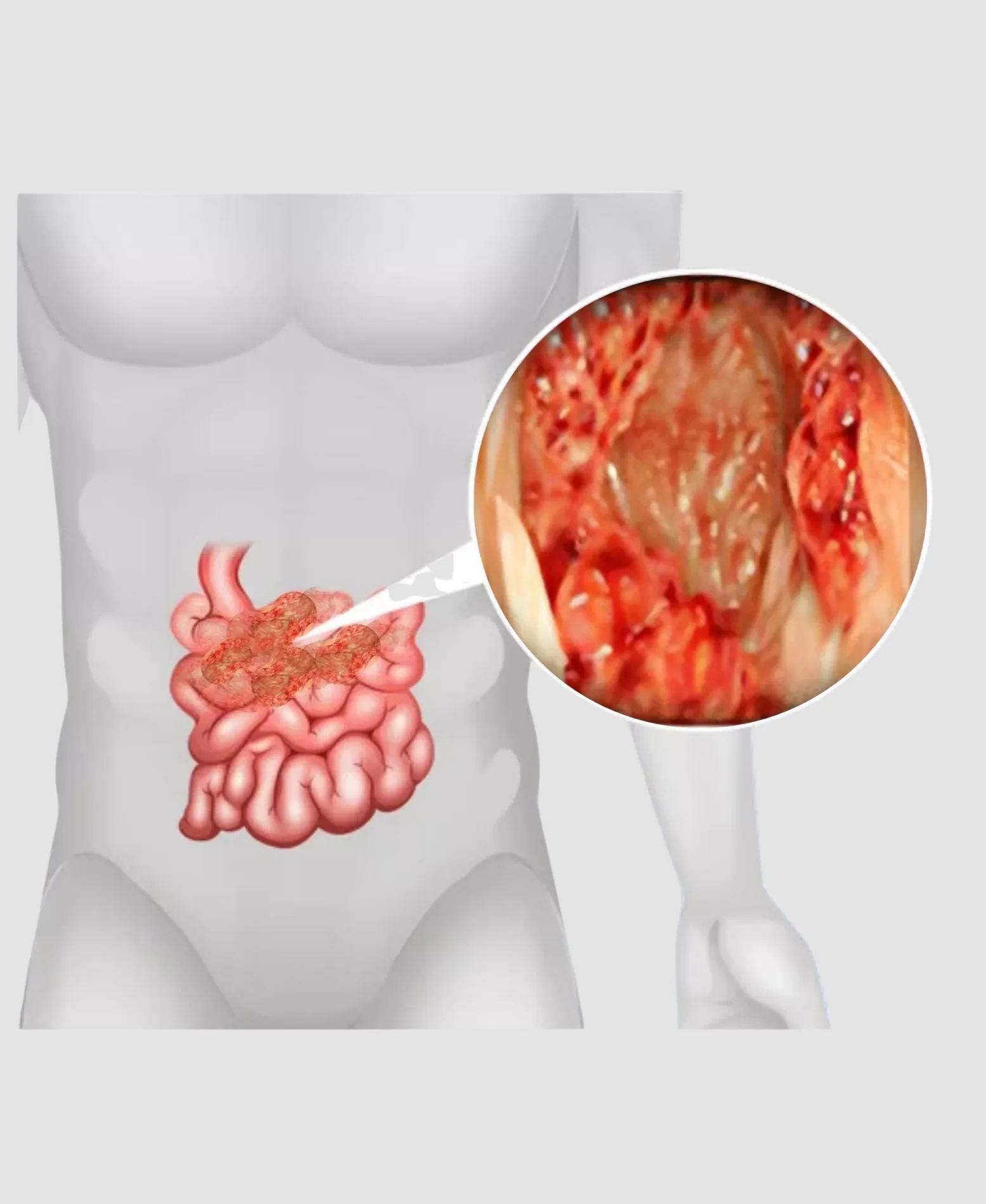 Dr. Neel Patel - Small Intestine care at Niraaya Hospital Gandhinagar